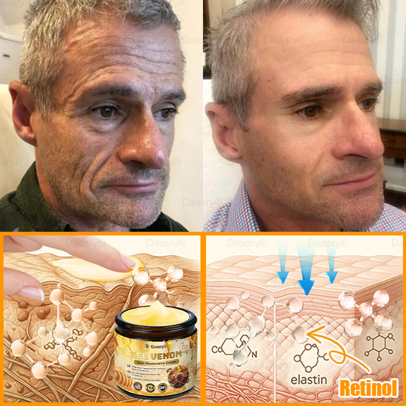 FDA Official: Daasry® Botox Bee Venom Skin Restoration Cream - Anti-aging, Hydrating, Skin Firming & Lifting, Skin Repair, Even Tone, Acne and Dark Spot Treatment, Wart and Mole Removal, and Psoriasis Relief.