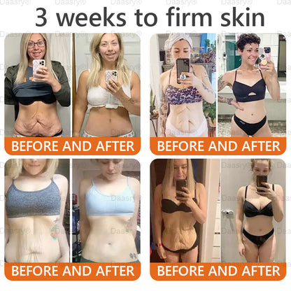"Only 10 jars left — grab this exclusive upsell with an extra 30% OFF for faster slimming & firming in just 1–4 weeks!Daasry®"