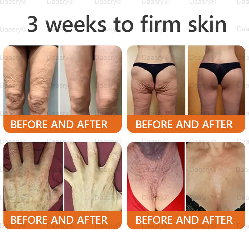 "Only 10 jars left — grab this exclusive upsell with an extra 30% OFF for faster slimming & firming in just 1–4 weeks!Daasry®"