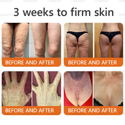 "Only 10 jars left — grab this exclusive upsell with an extra 30% OFF for faster slimming & firming in just 1–4 weeks!Daasry®"