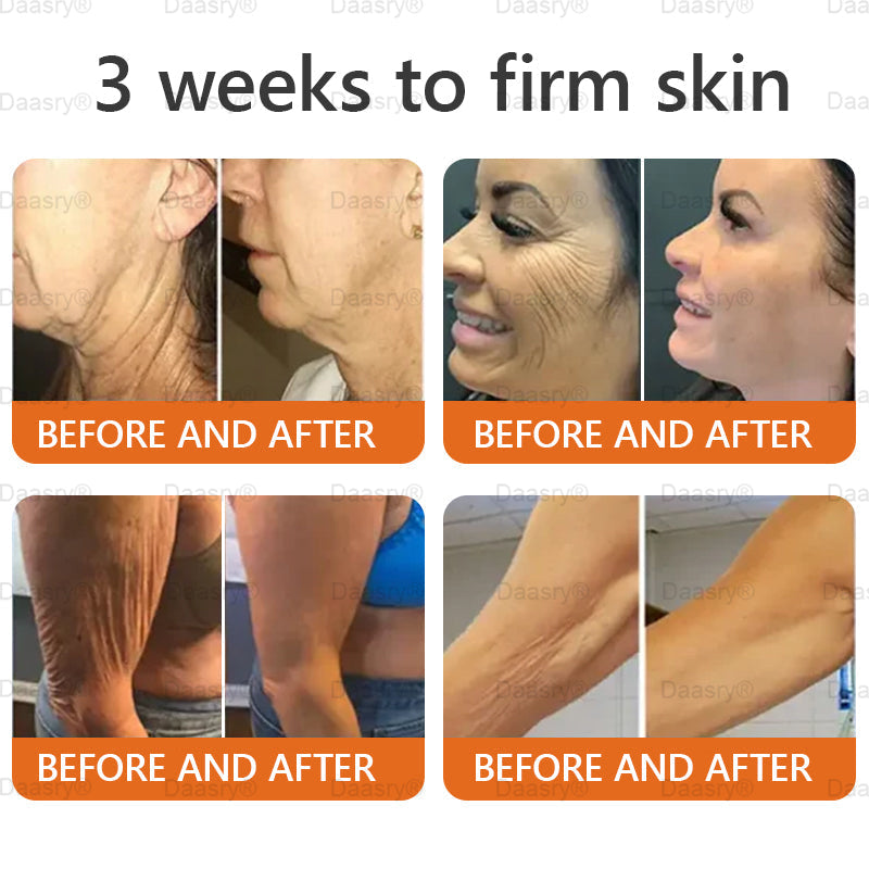 FDA Official: Daasry® Botox Bee Venom Skin Restoration Cream - Anti-aging, Hydrating, Skin Firming & Lifting, Skin Repair, Even Tone, Acne and Dark Spot Treatment, Wart and Mole Removal, and Psoriasis Relief.