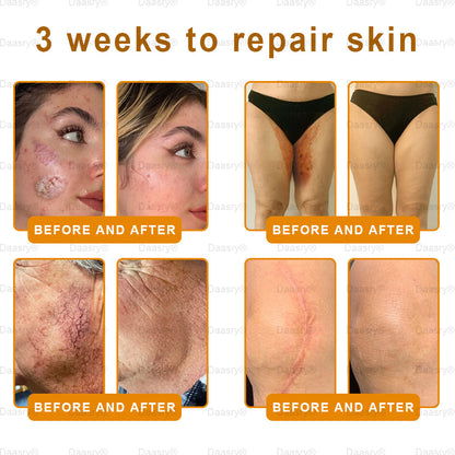 FDA Official: Daasry® Botox Bee Venom Skin Restoration Cream - Anti-aging, Hydrating, Skin Firming & Lifting, Skin Repair, Even Tone, Acne and Dark Spot Treatment, Wart and Mole Removal, and Psoriasis Relief.