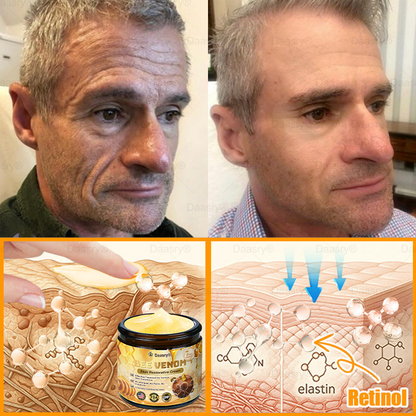 FDA Official: Daasry® Botox Bee Venom Skin Restoration Cream - Anti-aging, Hydrating, Skin Firming & Lifting, Skin Repair, Even Tone, Acne and Dark Spot Treatment, Wart and Mole Removal, and Psoriasis Relief.