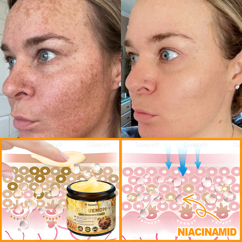 FDA Official: Daasry® Botox Bee Venom Skin Restoration Cream - Anti-aging, Hydrating, Skin Firming & Lifting, Skin Repair, Even Tone, Acne and Dark Spot Treatment, Wart and Mole Removal, and Psoriasis Relief.