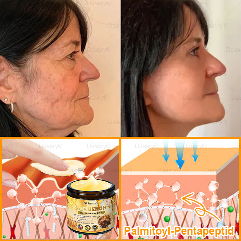 FDA Official: Daasry® Botox Bee Venom Skin Restoration Cream - Anti-aging, Hydrating, Skin Firming & Lifting, Skin Repair, Even Tone, Acne and Dark Spot Treatment, Wart and Mole Removal, and Psoriasis Relief.