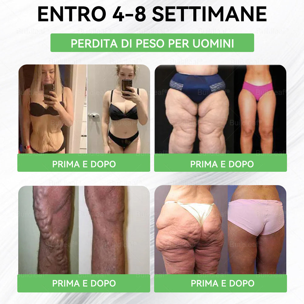 IT Negozio ufficiale🔥BuildLeaf® GLP-1 8-in-1 Fit & Vital Soluzione Orale (Solo una volta al giorno, cambiamenti visibili in 7 giorni) ✅ Per obesità, salute cardiovascolare, diabete, apnea notturna, salute intestinale, problemi articolari e altro